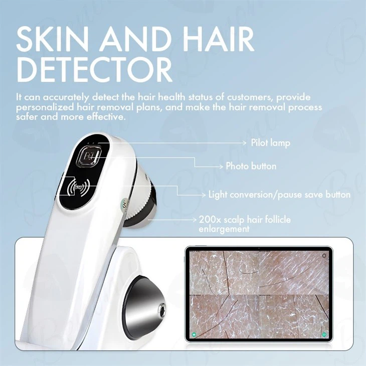2024 Hot Sales AI Laser Hair Removal Machine