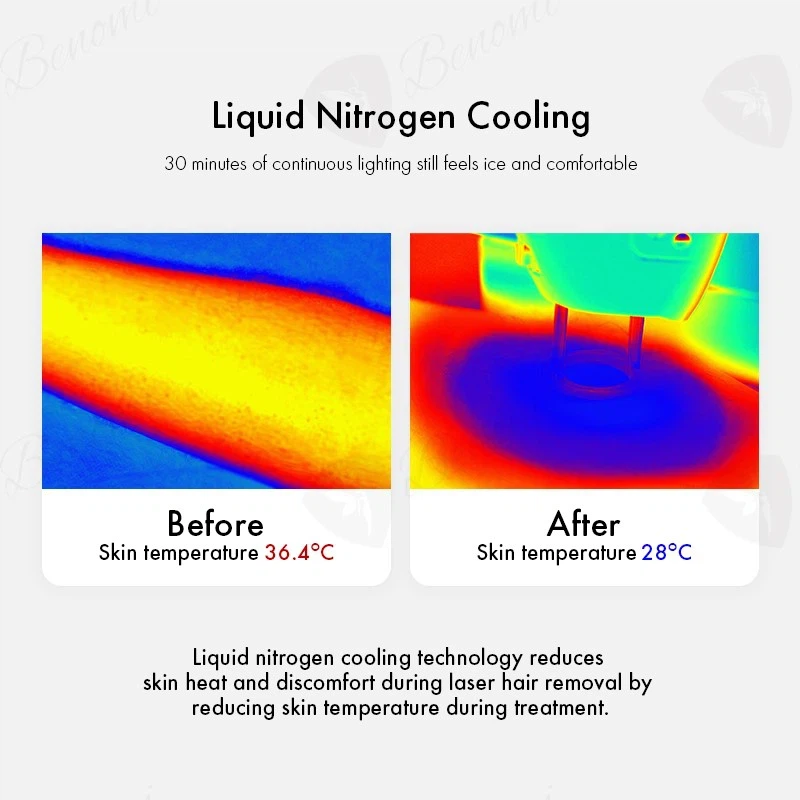 Liquid Nitrogen Refrigeration